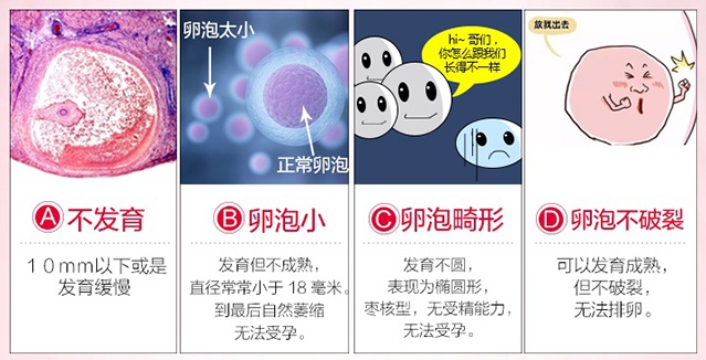 1523604899125239.jpg 卵泡发育不良分类_看图王(1).jpg