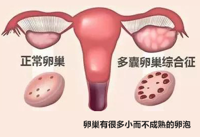 1519885649125725.jpg 1469573680468_993233.jpg