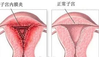 1539149269134392.jpg 640.webp.jpg