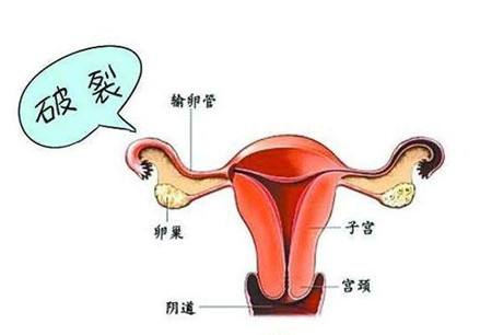 1539766346519221.jpg 1539766346519221.jpg